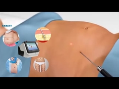 Laser Lipo Ekipmanı 30W 60W 980nm Diyot Lipo Lazer Ağırlık Kaldırma Makinesi